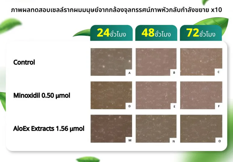 毛囊细胞测试结果照片