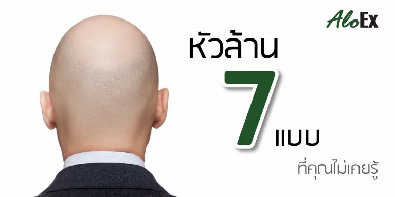 7 种秃头类型