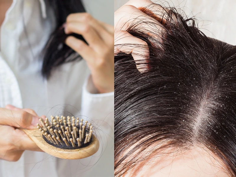 Reduce thinning and regrow new hair — the organic way