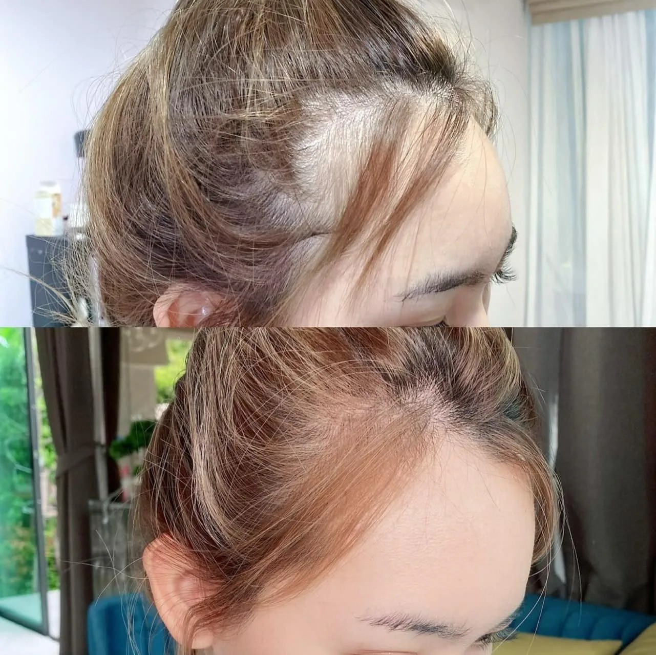 เป็นสาวกแชมพู ครีมนวดผมและกินอาหารเสริมม AloEx มานาน นอกจากจะช่วยเรื่องลดผมร่วง เพิ่มลูกผม ผลพลอยได้คือ ช่วยบำรุงเส้นผมให้ผมดกหนา เงาสวยอีกด้วย