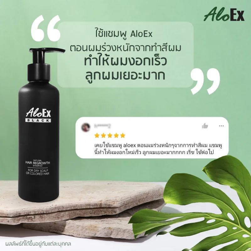 ใช้แชมพู AloEx ตอนผมร่วงหนักจากทำสีผมทำให้ผมงอกเร็ว ลูกผมเยอะมาก