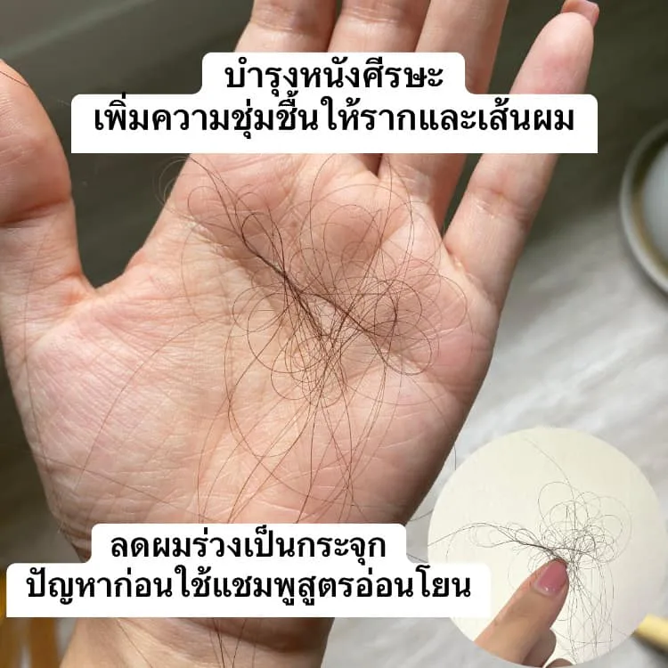 ဒါဟာ ပိုကောင်းတဲ့ ဖော်မြူလာတစ်ခုအဖြစ် မှတ်ထားရမယ်၊ သုံးပြီး ဆံပင်ကြွေမှုနည်းပါးစေပြီး ကြမ်းခြစ်ဆံပါ တစ်ပြိုင်တည်း လျော့ပါးစေတယ် - AloEx ဆံပင်ကြွေမှုရပ်တန့်အောင်ကူညီ၊ ဆံပင်ပါးခြင်းလျှော့ချ၊ ဆံပင်သစ်ဖွားစေသည်