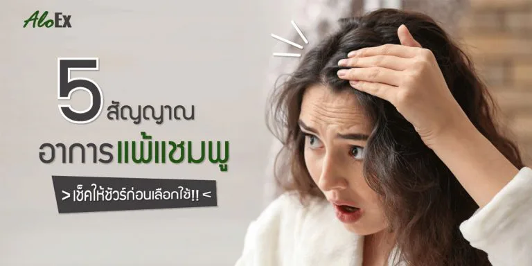 5 signs of shampoo allergy — check before you choose