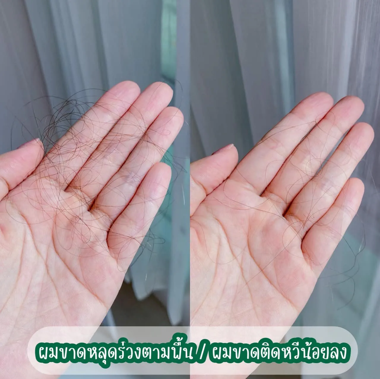 ဆံပင်ကျွတ်မှုကို တကယ်လျှော့ချပေးတဲ့ ရှန်ပူးကို အခုပြောင်းသုံးနေပြီ â€” AloEx