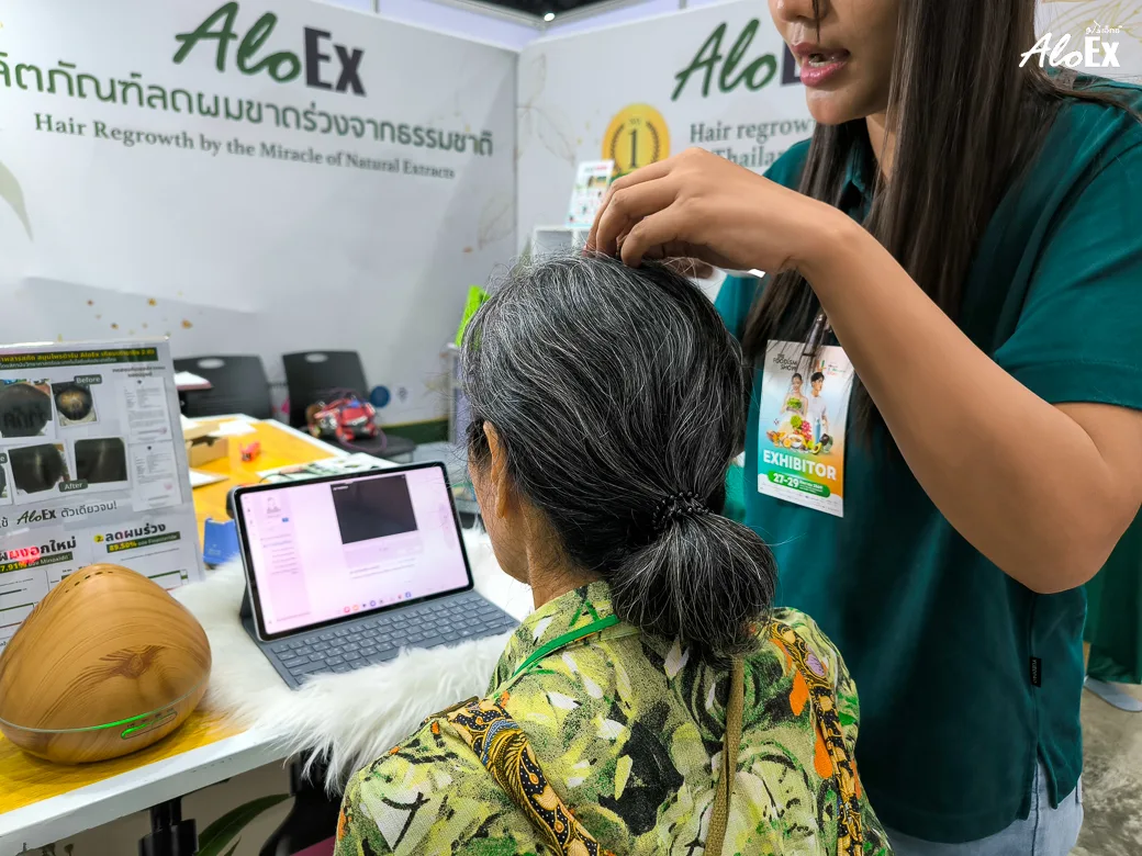 ผู้เชี่ยวชาญ AloEx วิเคราะห์สภาพหนังศีรษะและให้คำปรึกษาผู้เข้าชมงานที่บูธ B26