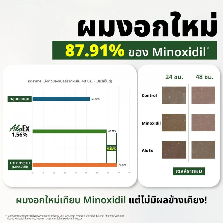 AloEx နှင့် Minoxidil နှိုင်းယှဉ်ချက်