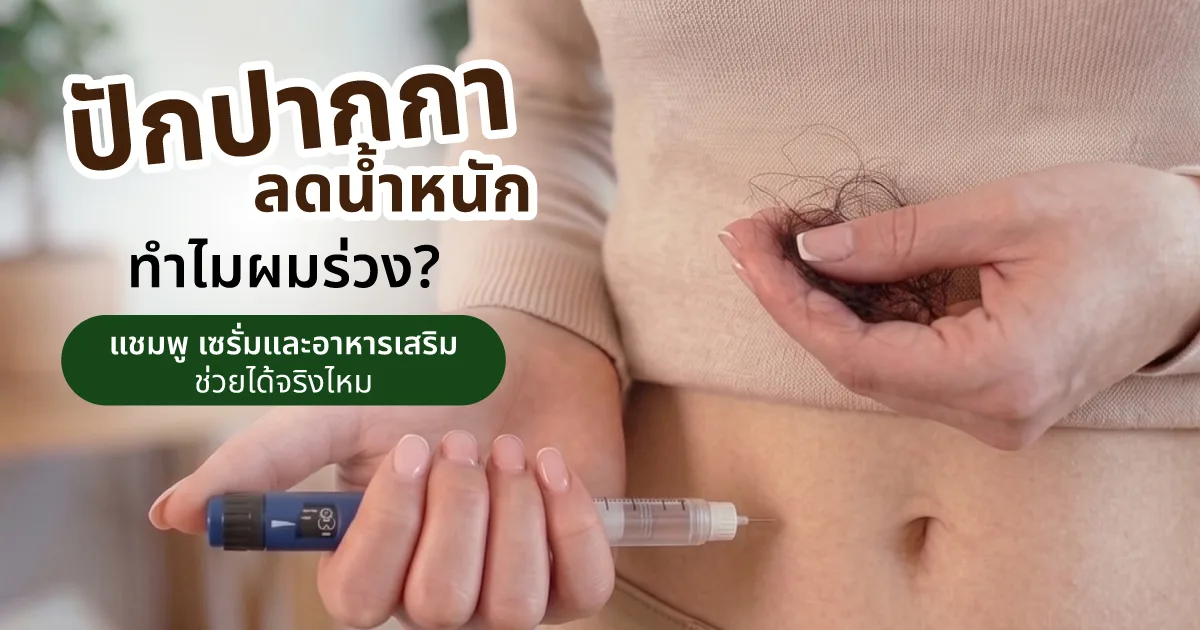 ปักปากกาลดน้ำหนัก GLP-1 ทำให้ผมร่วง สาเหตุและวิธีแก้