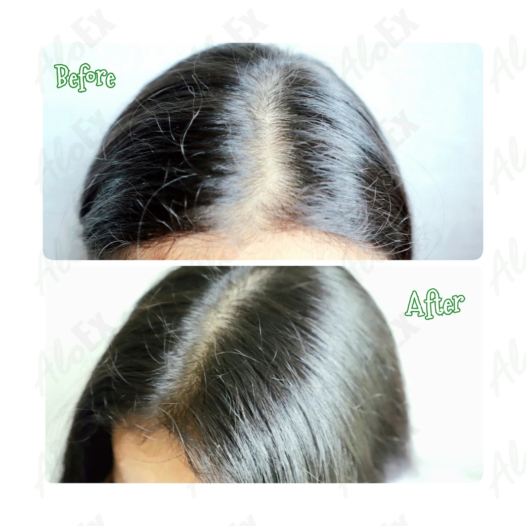 မသုံးမီနှင့် သုံးပြီးနောက် — AloEx ထုတ်ကုန်များ