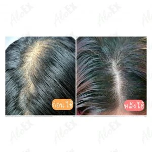 AloEx产品使用前后对比评测