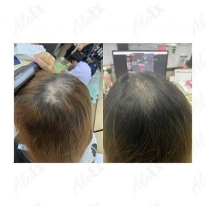 AloEx产品使用前后对比评测