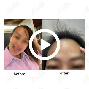 AloEx产品使用前后对比评测