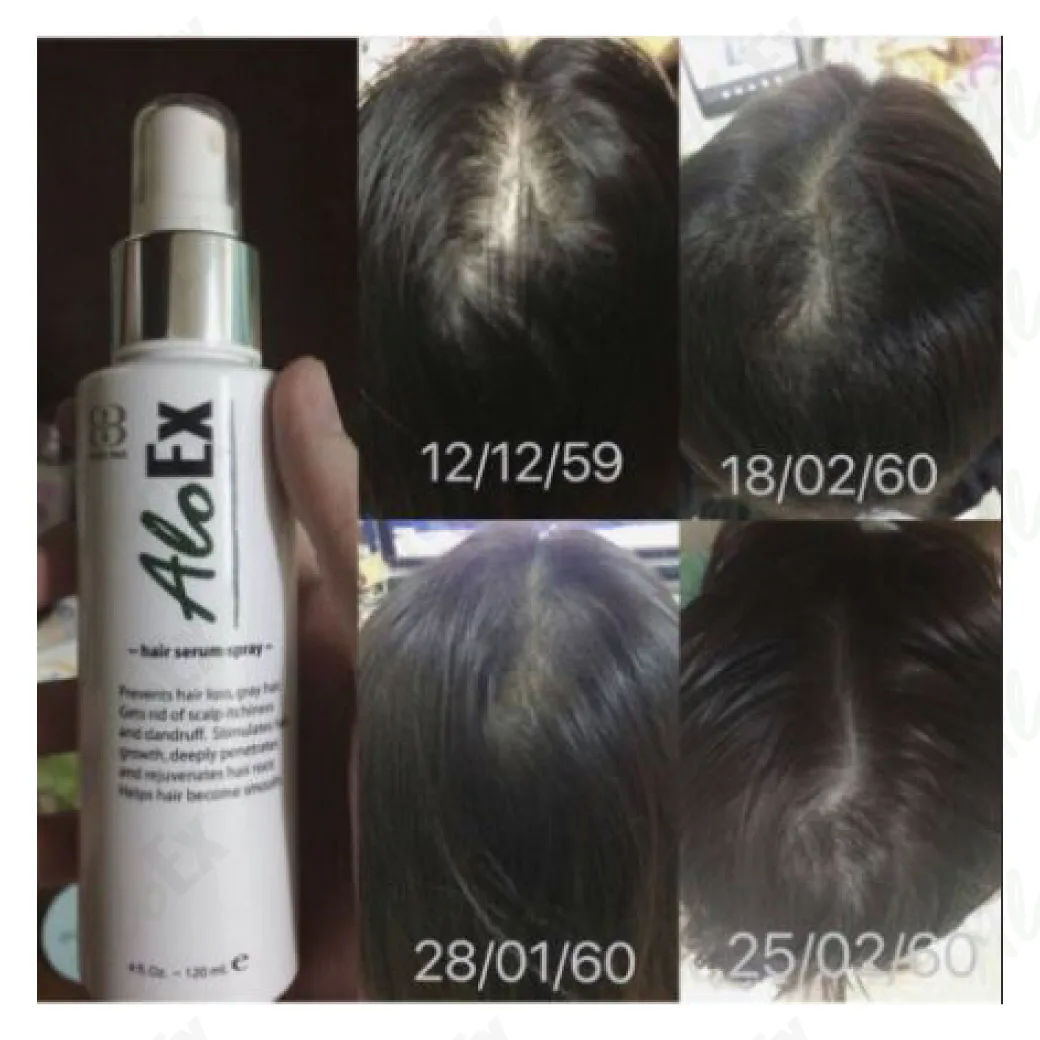 မသုံးမီနှင့် သုံးပြီးနောက် — AloEx ထုတ်ကုန်များ