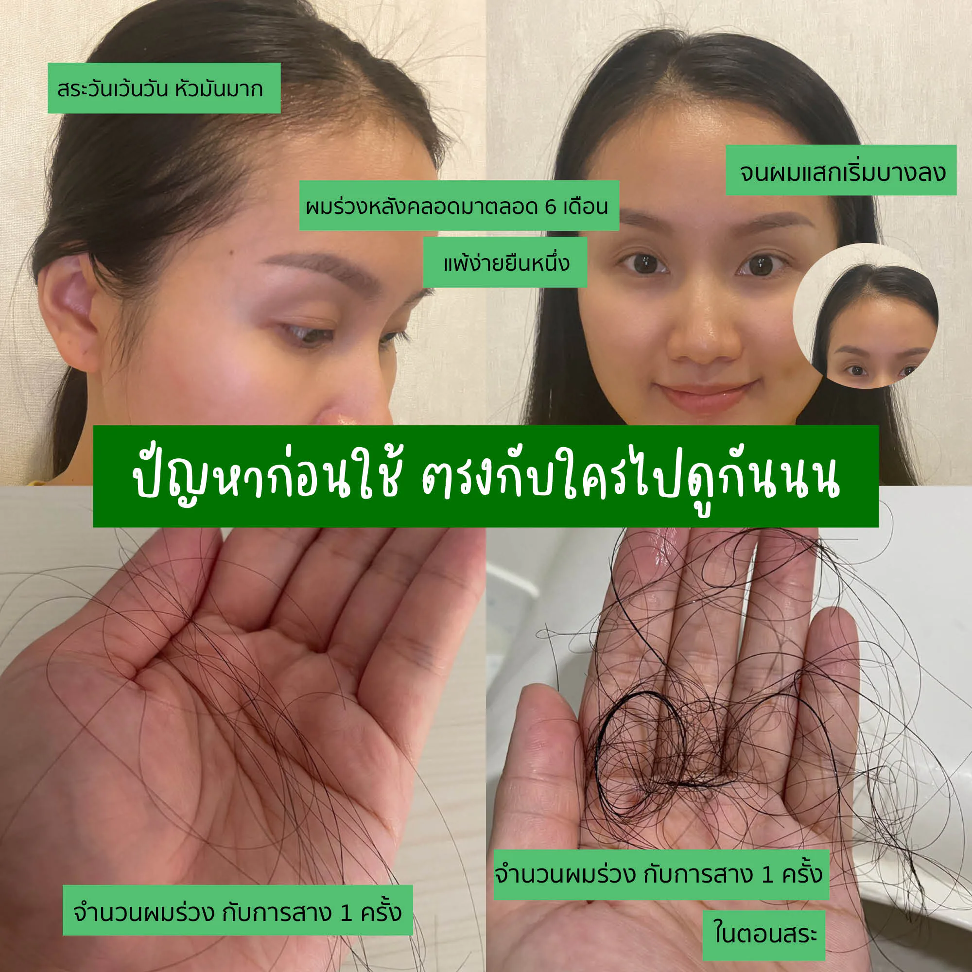 ต้อนรับการกลับมาด้วยแชมพูแก้ผมร่วง ของคุณแม่หลังคลอด และผู้แพ้ง่าย AloEx Extra Mild