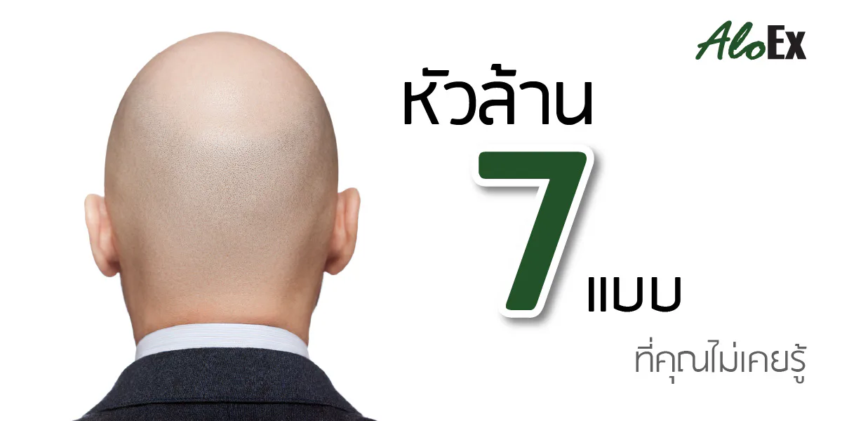 7 种秃头类型