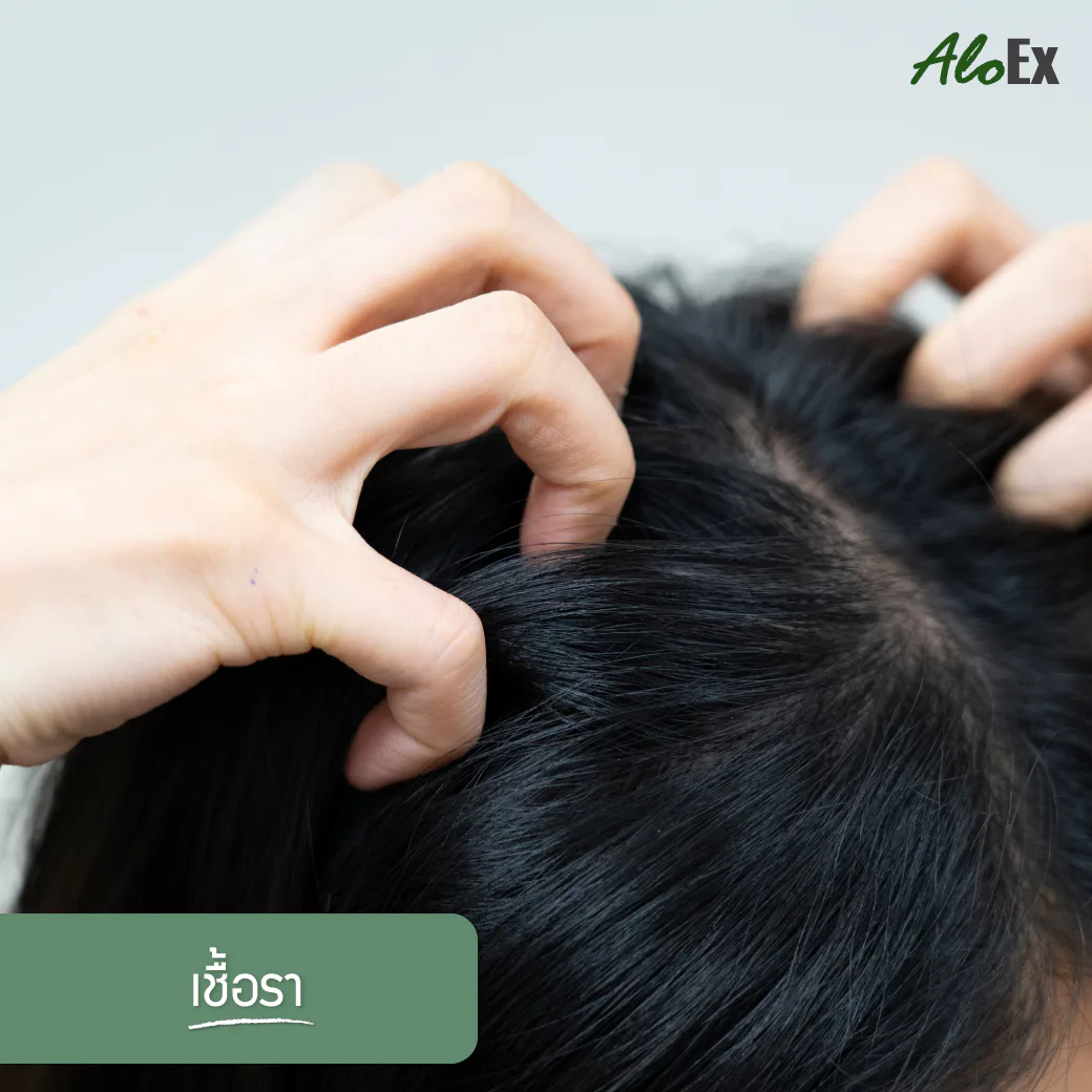 9 causes of severe hair loss — 10