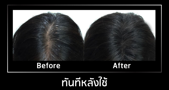 AloEx Natural Hair Fiber အသုံးပြုနည်း