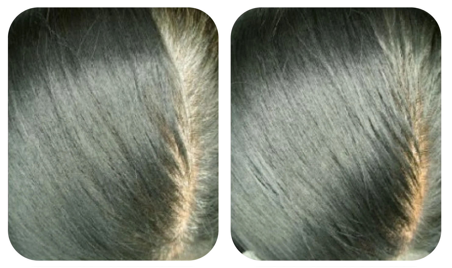 使用 AloEx Organic Intensive Hair Serum 前后的头皮对比，第 2 张