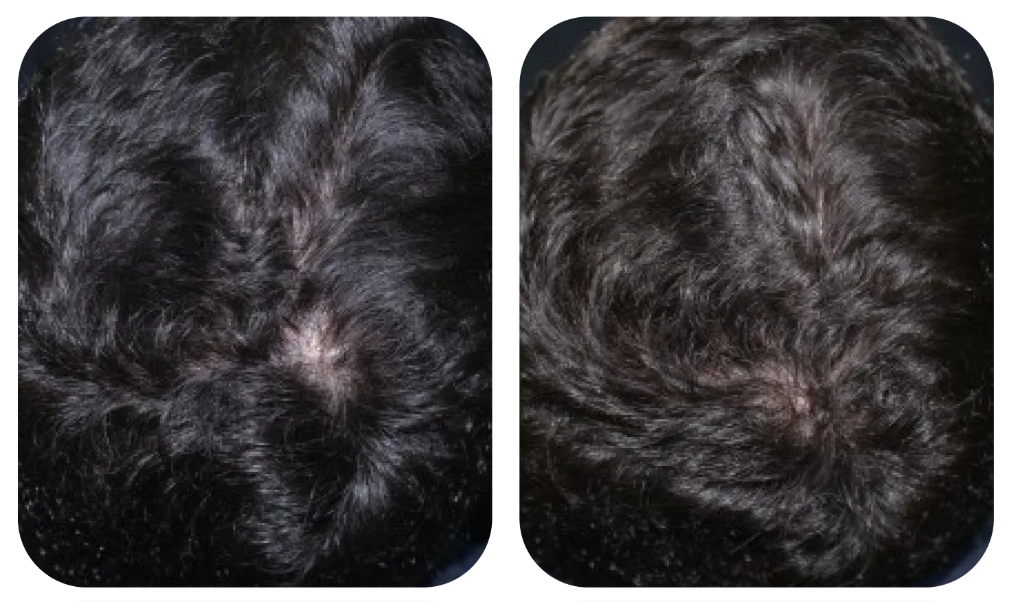 使用 AloEx Organic Intensive Hair Serum 前后的头皮对比，第 3 张
