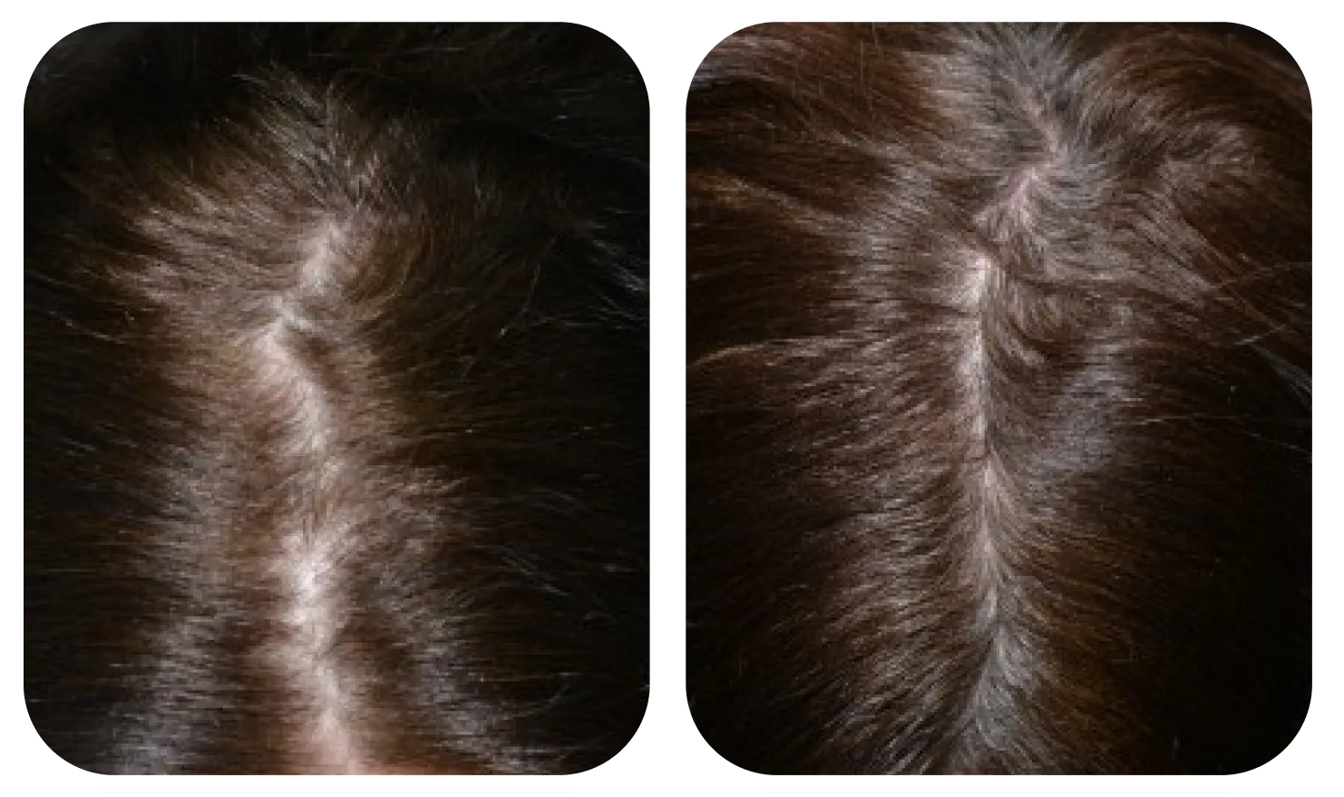 使用 AloEx Organic Intensive Hair Serum 前后的头皮对比，第 5 张
