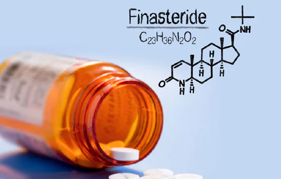Unexpected Dangers of Using Finasteride