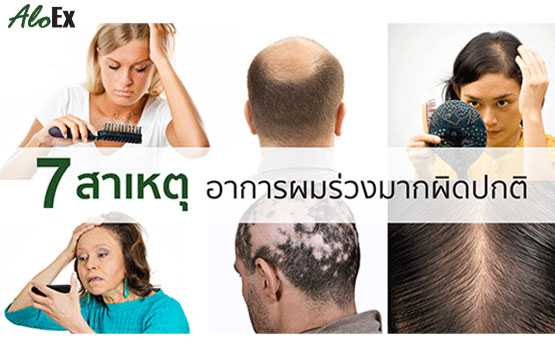 ผมร่วงนี้มีที่มา 7 สาเหตุอาการผมร่วงมากผิดปกติ