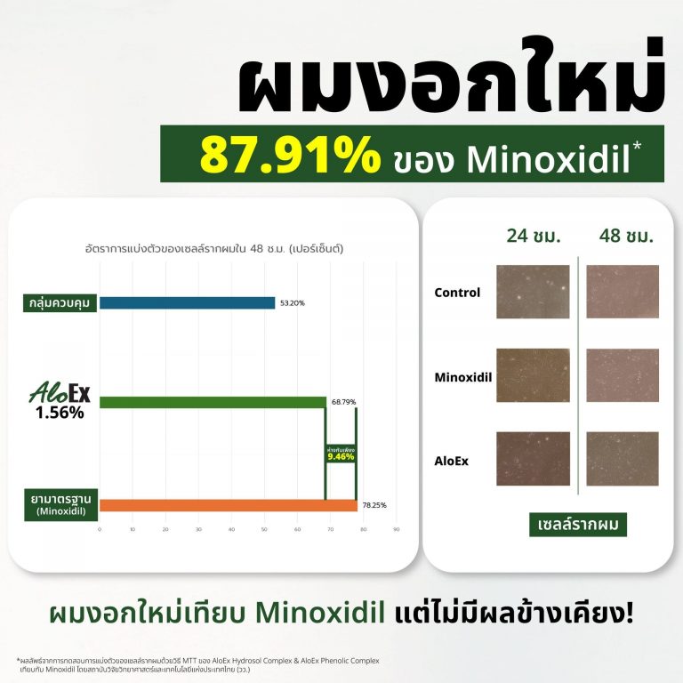 AloEx เทียบตัวยา Minoxidil